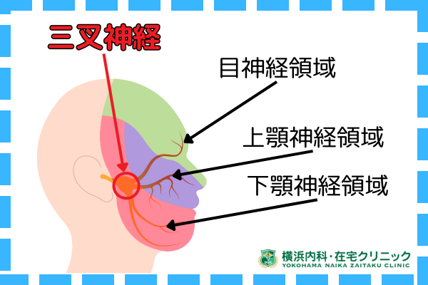 片頭痛