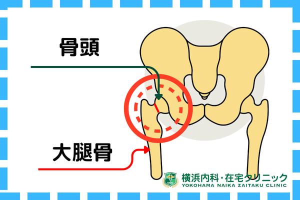 子供の成長痛