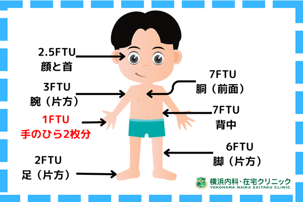 アトピー性皮膚炎の原因