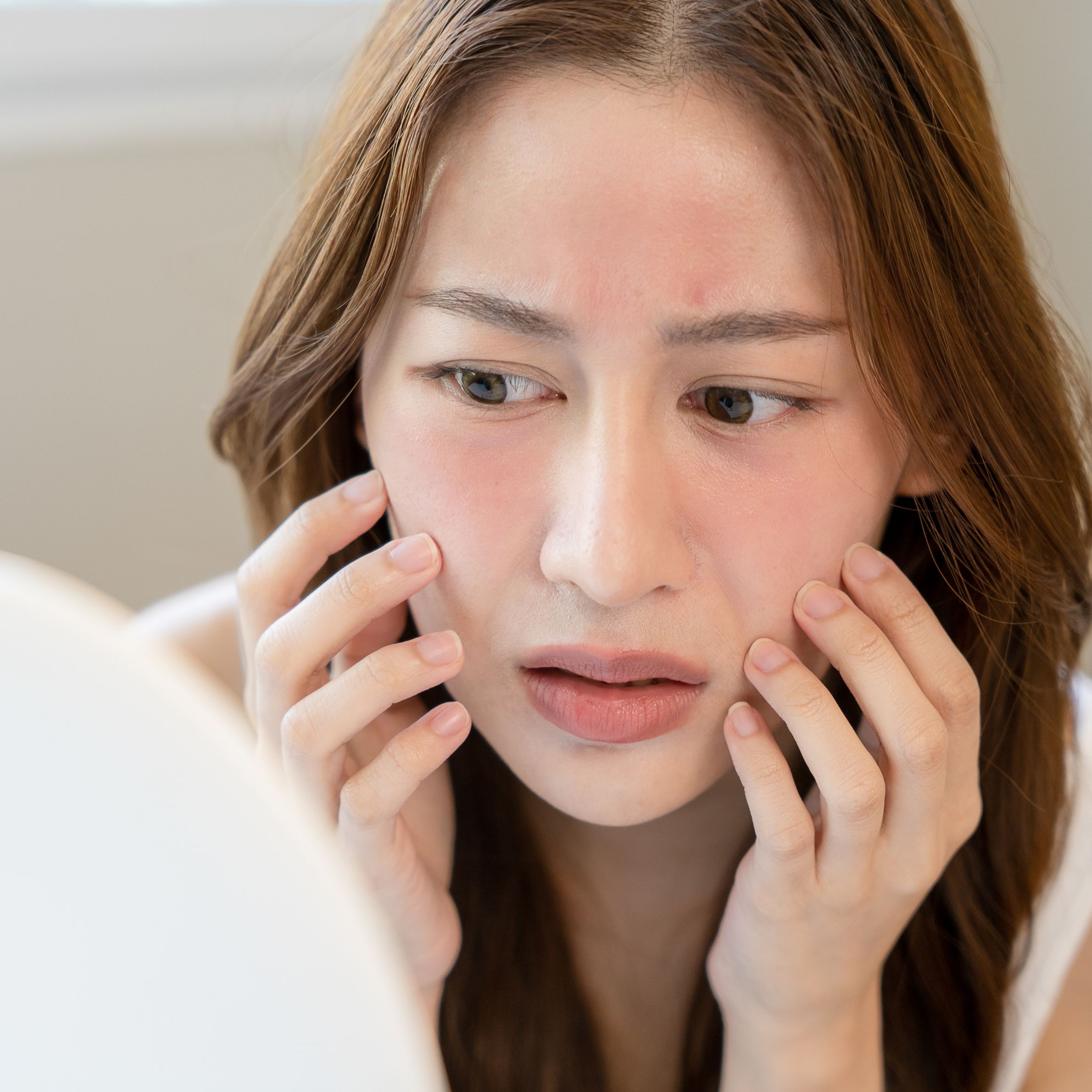 ニキビイメージ